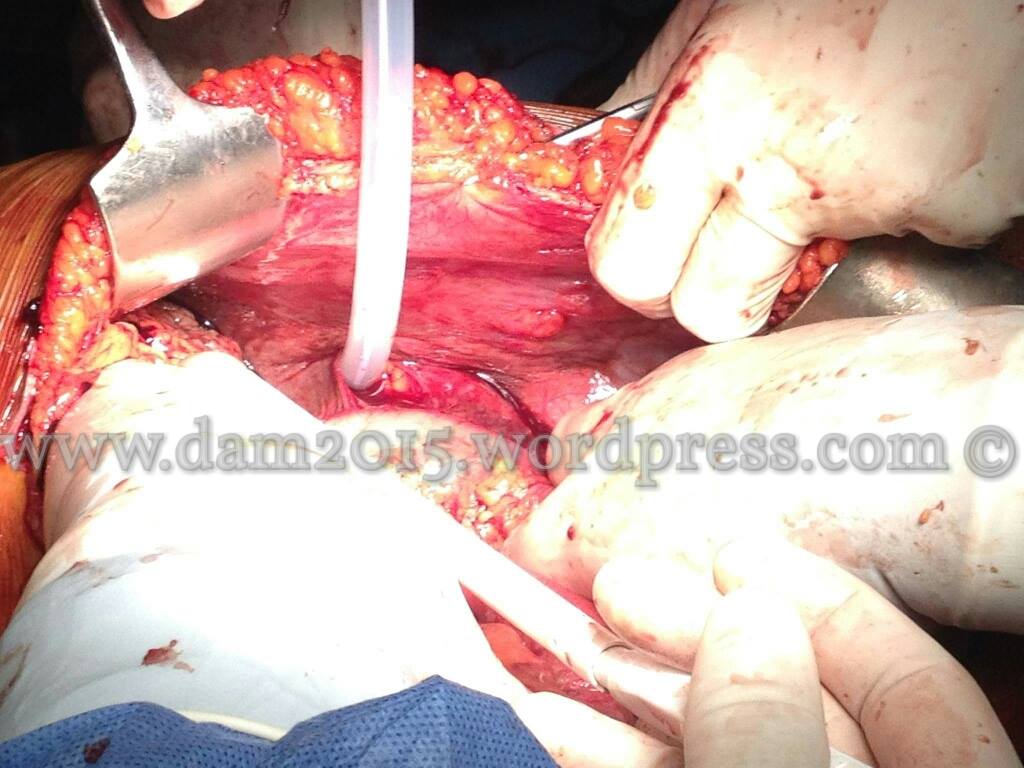 13211059_10208092819031248_1267429744_o