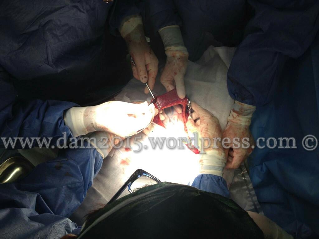 13214920_10208092818991247_563985994_o