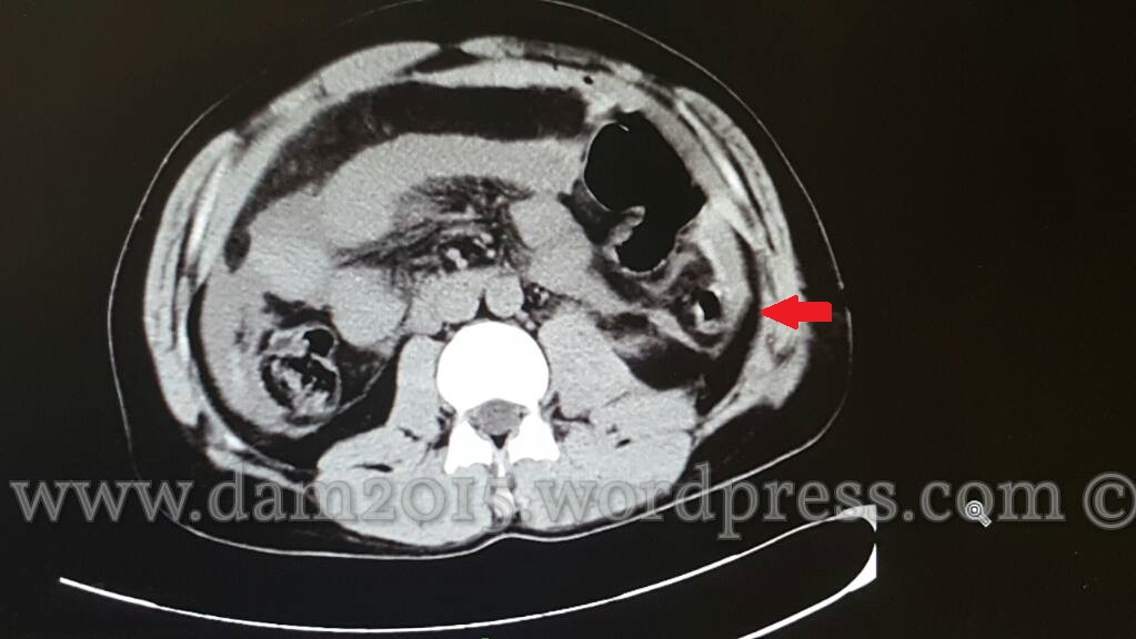 13225003_10208092819231253_93334983_o