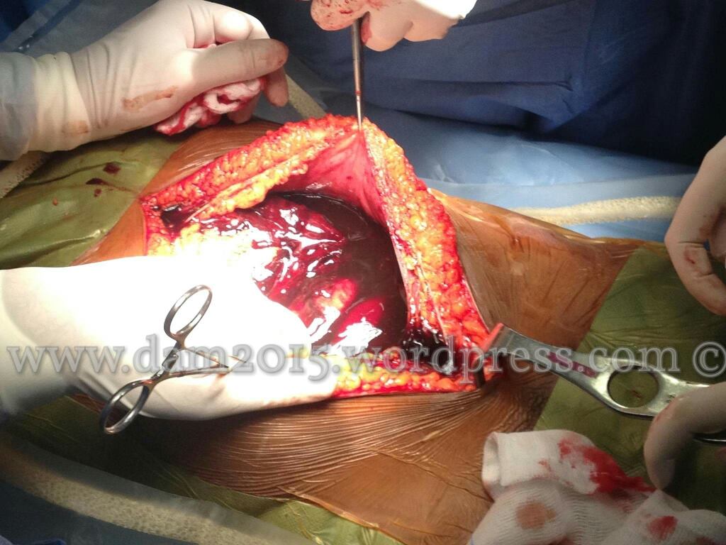 13230768_10208092818831243_979932698_o