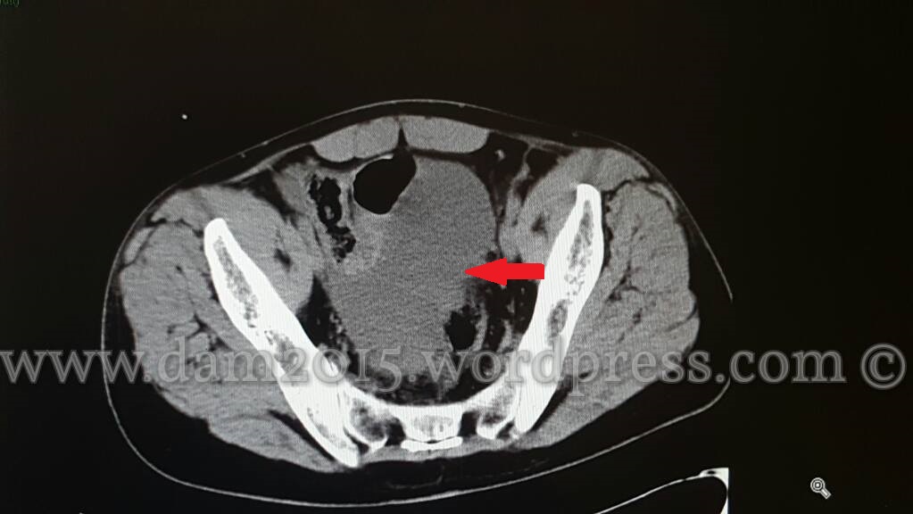 13230821_10208092819311255_1413241606_o