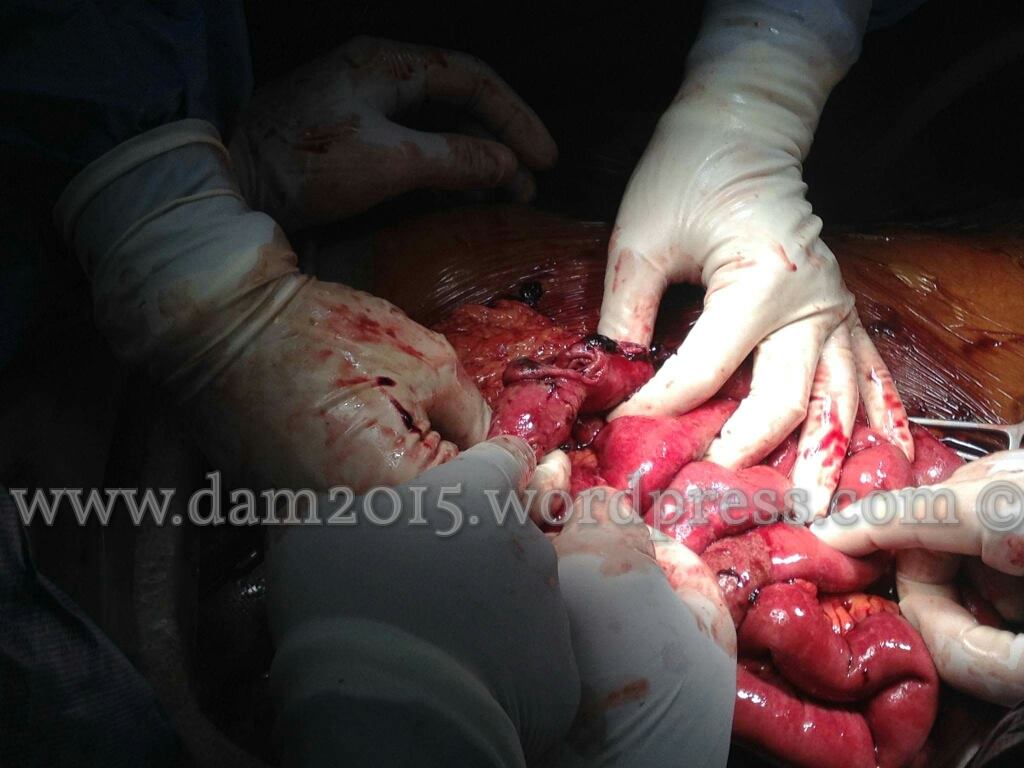 13230894_10208092818791242_309491100_o