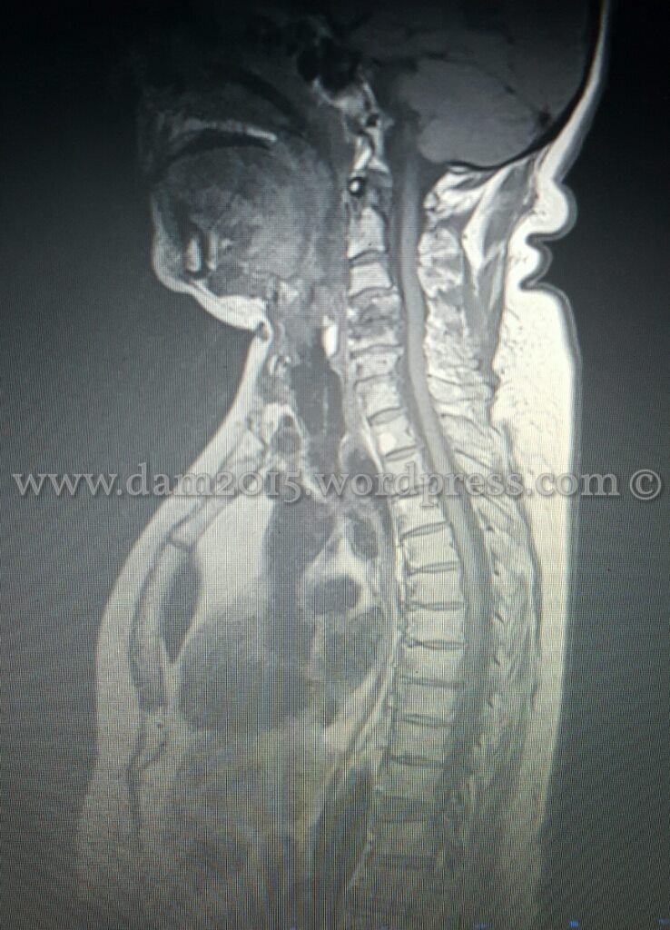 13234532_10208109321923810_1759135758_o