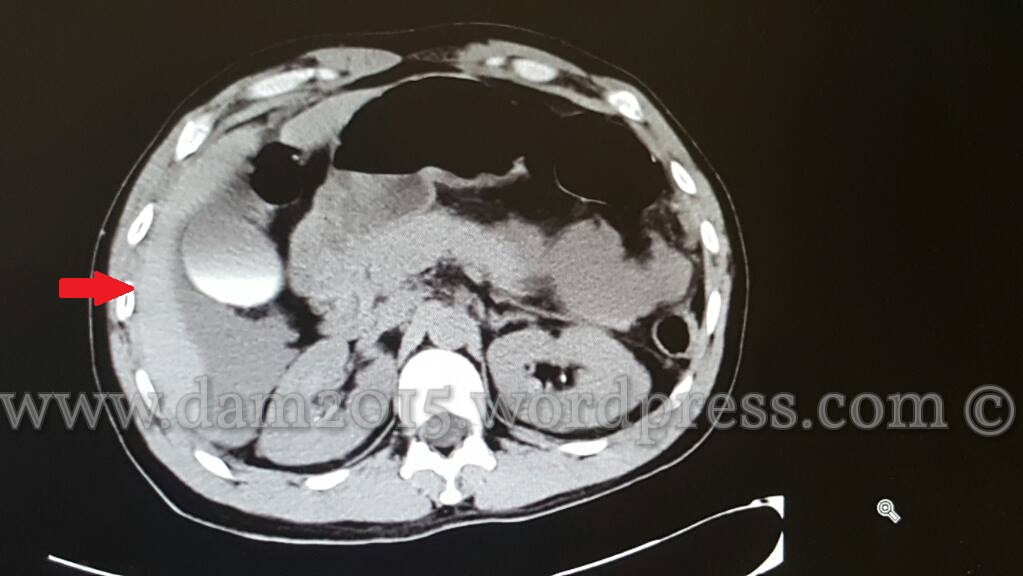 13234664_10208092819151251_416999291_o