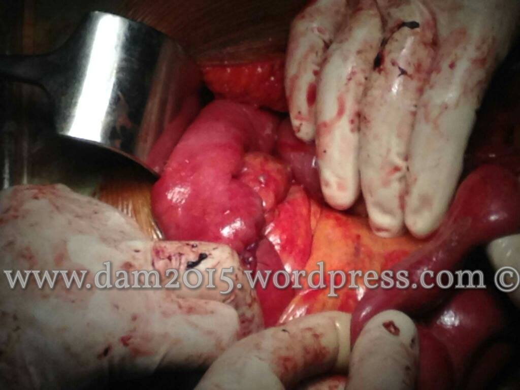 13234785_10208092819111250_2129689692_o