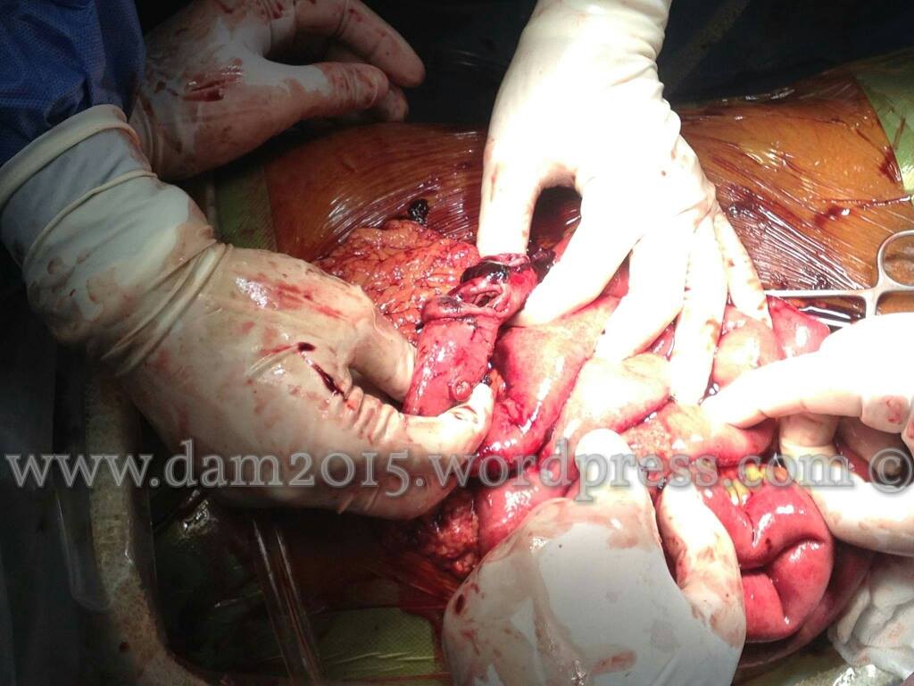 13234863_10208092818951246_1124090444_o