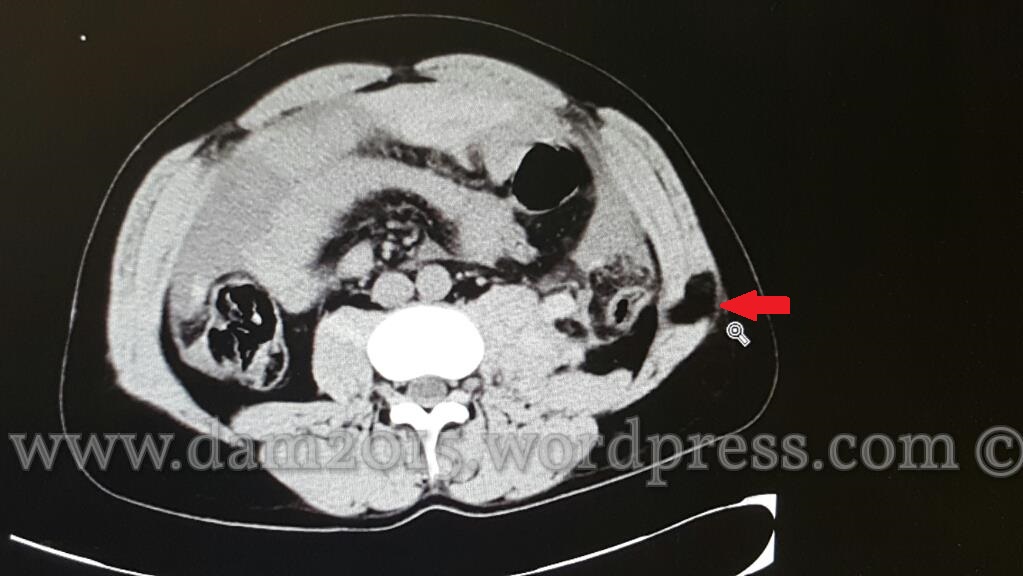 13262610_10208092819351256_1337570420_o