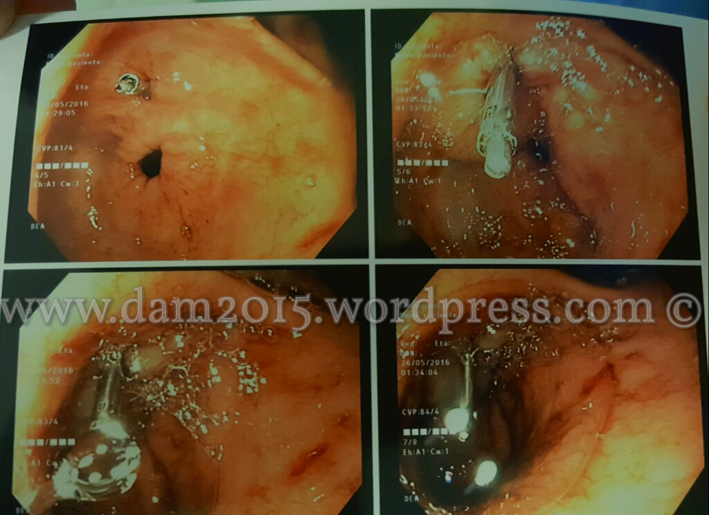 20160615_215520_wm.jpg image