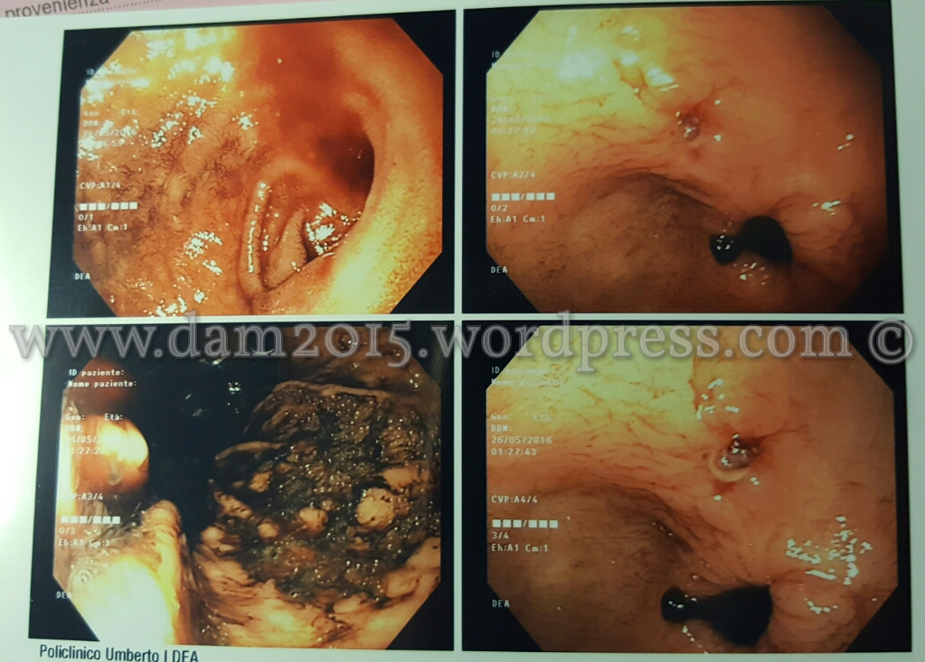 20160615_215602_wm.jpg image