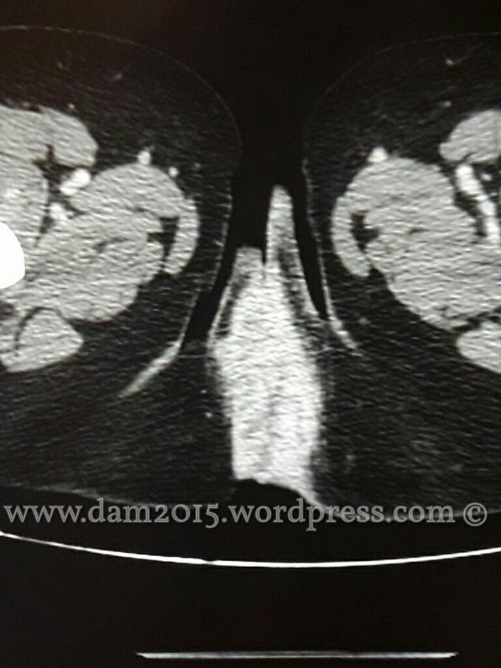 29920037_10213942123780211_139152900_n