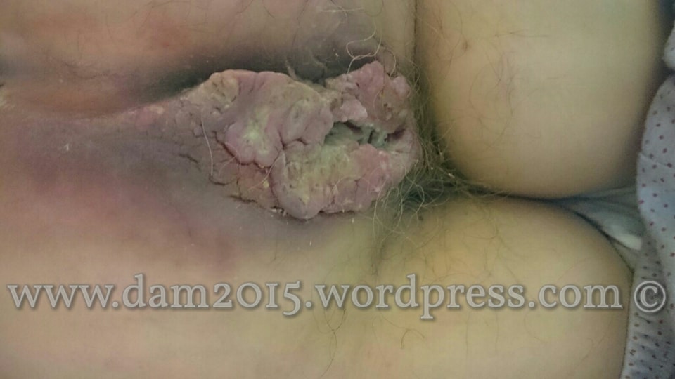 30007641_10213942124060218_1848608120_n