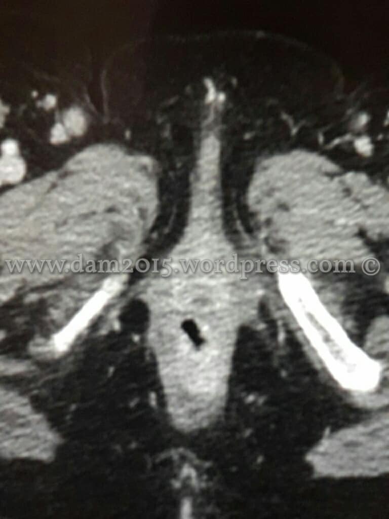 30074541_10213942123940215_254491947_o